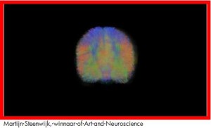 Winnaar Art of Neuroscience Martijn Steenwijk.jpg met rand